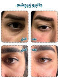 جالپرو زیر چشم یانگ ای کیفیت اصلی